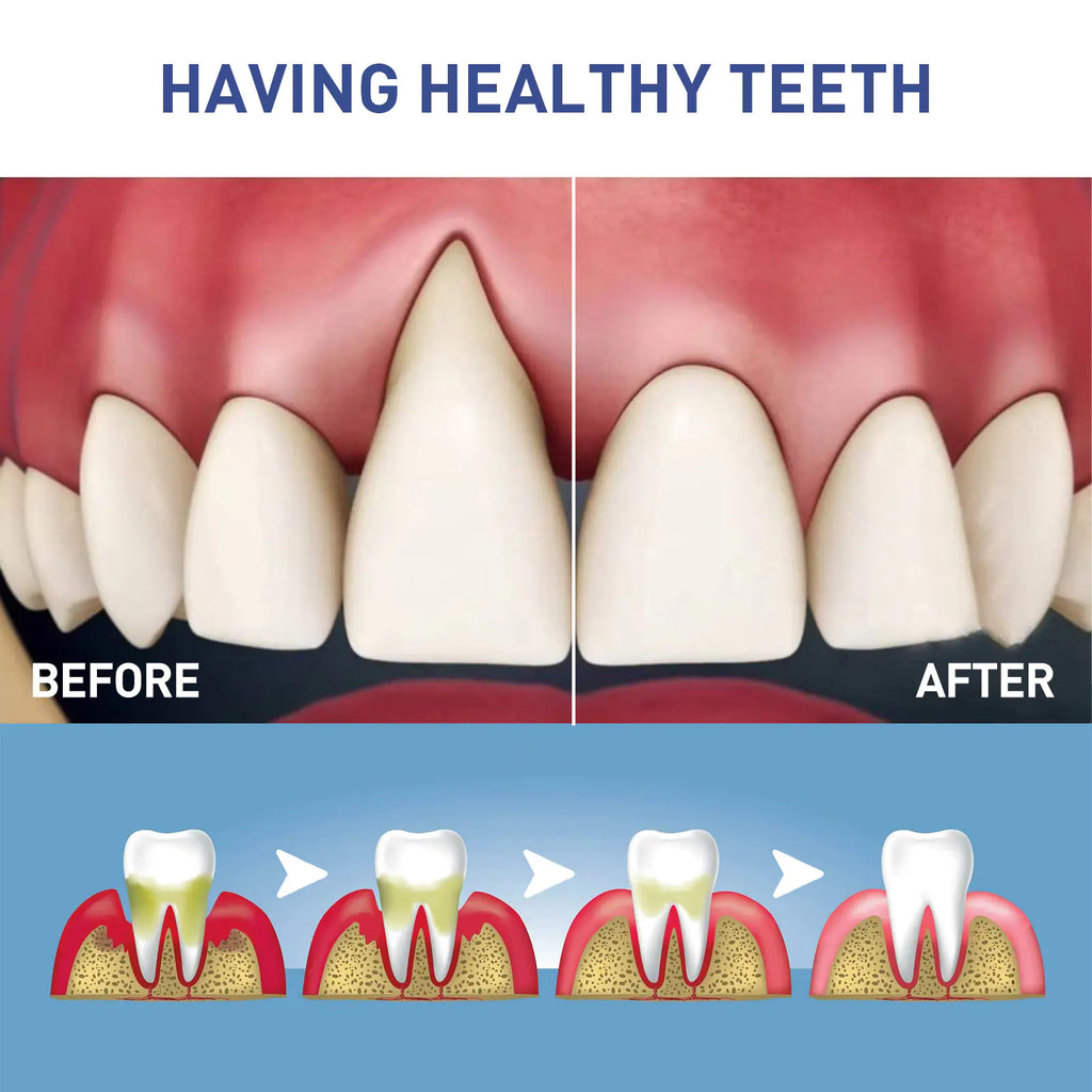 West&Month Gum Care Gel for Pain Relief and Whitening